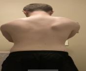 shoulder pain in the one with winging, is my shoulder injured? from shoulder riding slave